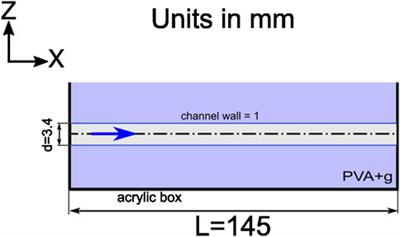 Ultrasound flow phantom for transcranial Doppler: An assessment of angular mismatch effect on blood velocity measurement in comparison to optical particle image velocimetry